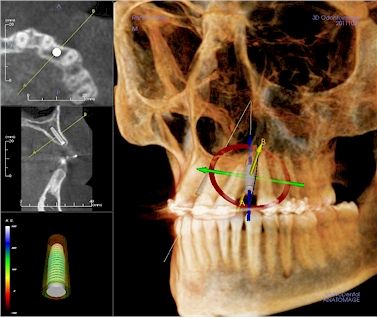 TAC · CBCT
