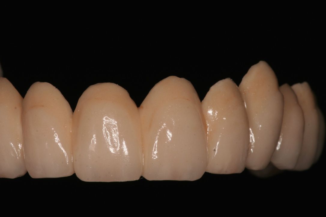 ceramicas
