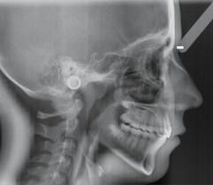 Teleradiography