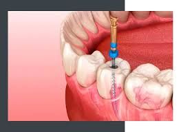 Endodontia Rotatória