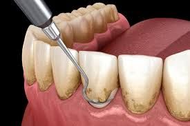 Periodontia