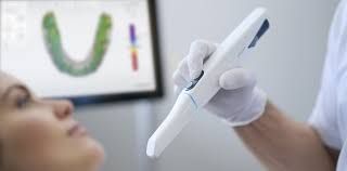 Scanner intraoral